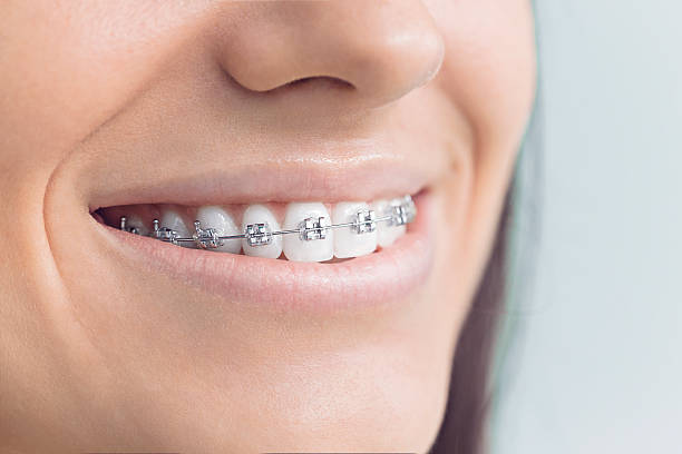 Best Crowns and Bridges  in Plainview, TX